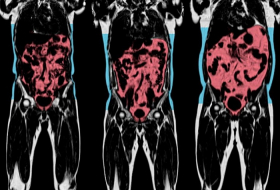World`s largest human scanning project raises hope of treating diseases before they happen